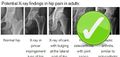 Causes of hip pain.jpg