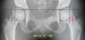 Reimer's migration index (crop).png